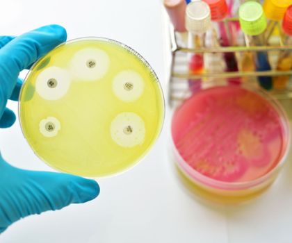 Biologisches Recycling von Kunststoff: Wie Mikroben Kunststoffe abbauen und verwerten können Biologisches Recycling von Kunststoff: Wie Mikroben Kunststoffe abbauen und verwerten können