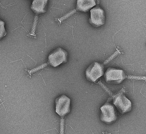 Genetisch modizierte Phagen: Erreger von Harnwegsinfektionen mit Hilfe von Phagen identifizieren Elektronenmikroskopische Aufnahme von Phagen
