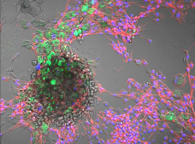 Nanoplastik in Tierzellen nachgewiesen Kombinierte Hellfeld- und Fluoreszenzmikroskopie von Rinderzellen