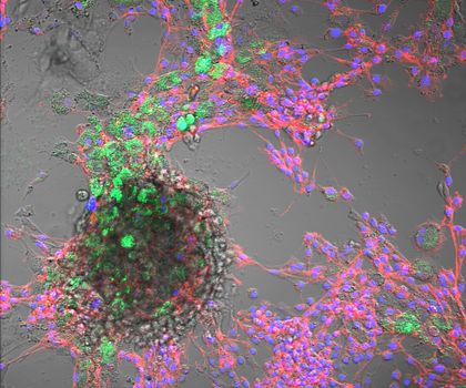 Nanoplastik in Tierzellen nachgewiesen Kombinierte Hellfeld- und Fluoreszenzmikroskopie von Rinderzellen