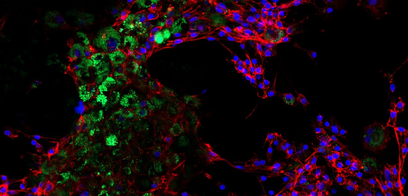 Mikroplastik in Rindern nachgewiesen Granulosazellen aus dem Rindereierstock nach acht Tagen Kontakt mit Nanoplastikpartikeln. Die grün-fluoreszierenden Polystyrolpartikel (100 nm) zeigen, wie das Nanoplastik in die Zellen aufgenommen wurde.