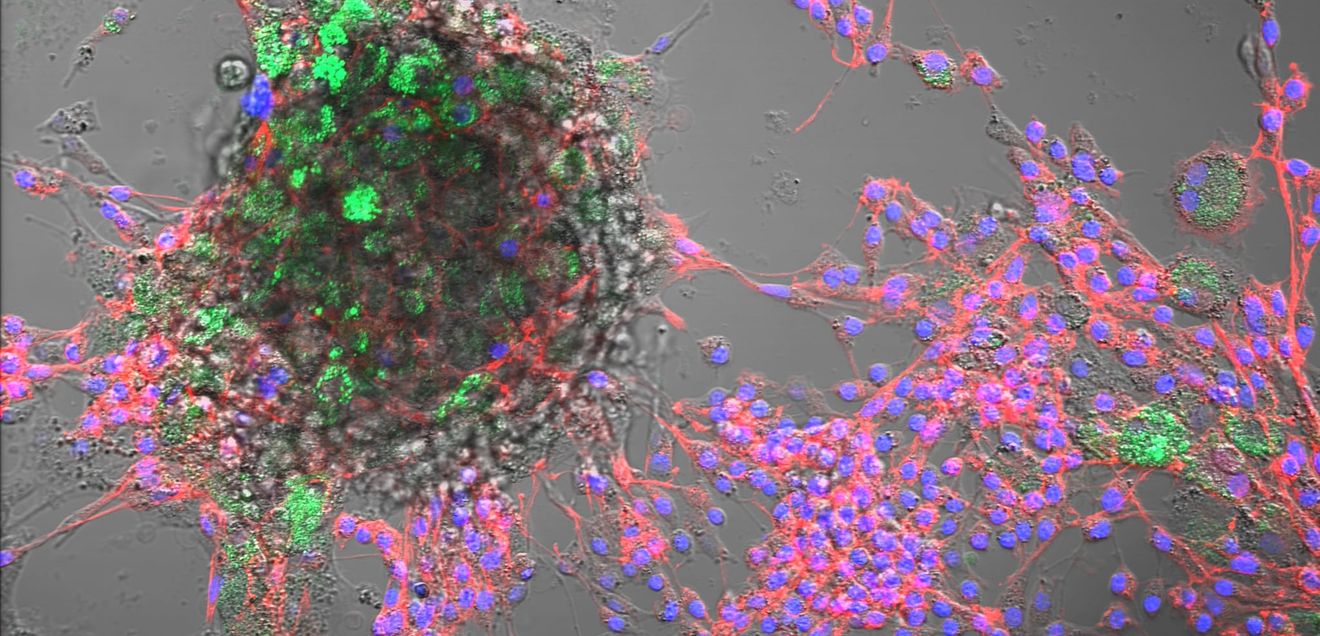 Nanoplastik in Tierzellen nachgewiesen Kombinierte Hellfeld- und Fluoreszenzmikroskopie von Rinderzellen