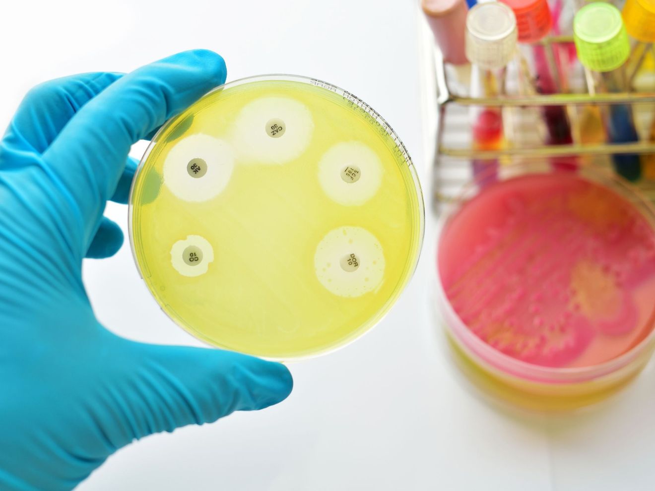 Biologisches Recycling von Kunststoff: Wie Mikroben Kunststoffe abbauen und verwerten können Biologisches Recycling von Kunststoff: Wie Mikroben Kunststoffe abbauen und verwerten können