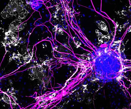 Co-Kulturen bestehend aus Neuronen, die Nervenfasern ausbilden und Oligodendrozyten, die diese Nervenfasern mit Myelin ummanteln. Co-Kulturen bestehend aus Neuronen, die Nervenfasern (pink) ausbilden und Oligodendrozyten, die diese Nervenfasern mit Myelin (weiß) ummanteln. Die Zellkerne sind blau angefärbt.
