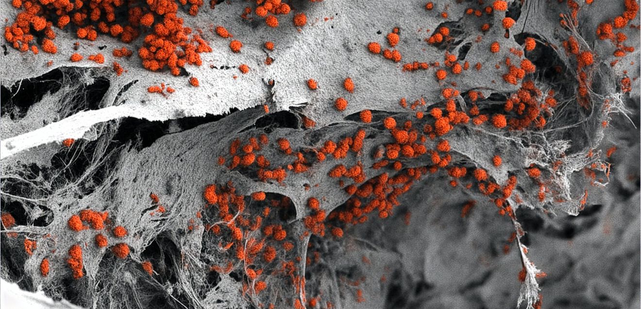 Menschliches Knochenmark im Labor nachgebildet - für humane Forschung und weniger Tierversuche Rasterelektronenmikroskopische Aufnahme des künstlich hergestellten 3D-Knochenmarkgewebes, das mit menschlichen Blutzellen (rot) besiedelt ist.