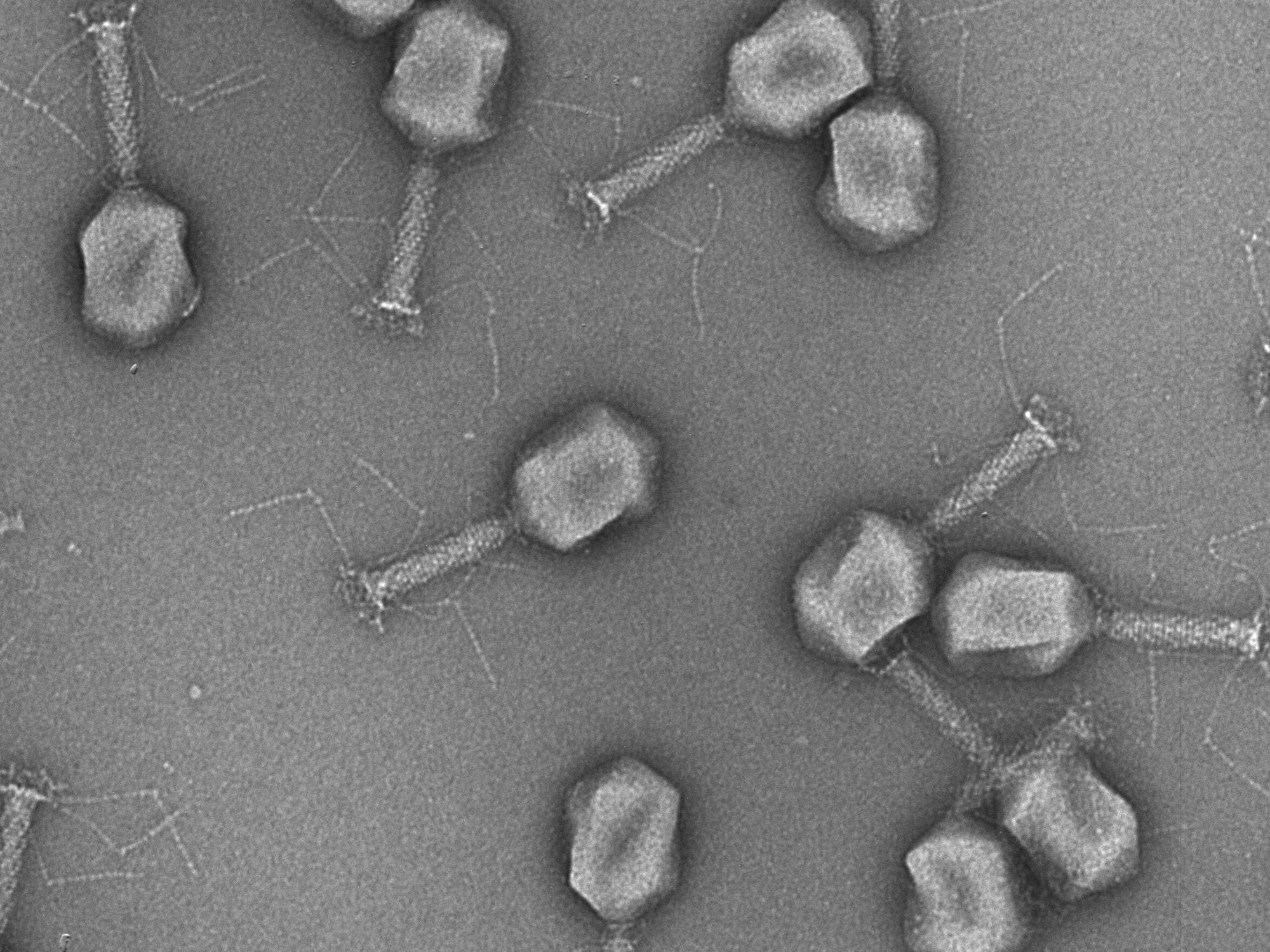 Elektronenmikroskopische Aufnahme von Phagen
