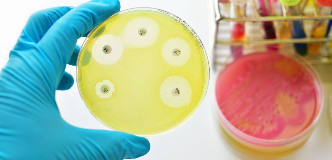 Biologisches Recycling von Kunststoff: Wie Mikroben Kunststoffe abbauen und verwerten können Biologisches Recycling von Kunststoff: Wie Mikroben Kunststoffe abbauen und verwerten können