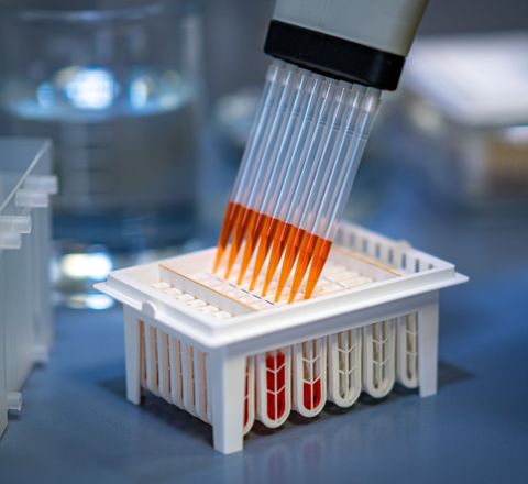 Parallel Pipettieren Dialysekartusche wird mit einer Multikanalpipette befüllt