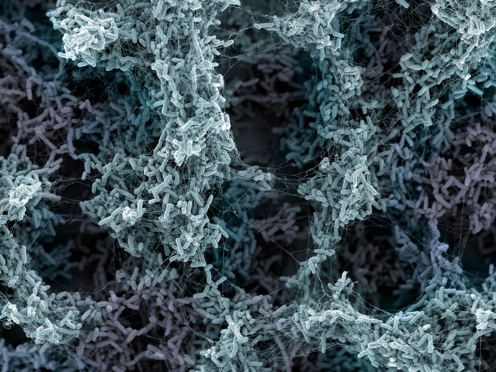 Der Krankheitserreger Pseudomonas aeruginosa bildet einen schützenden Biofilm.