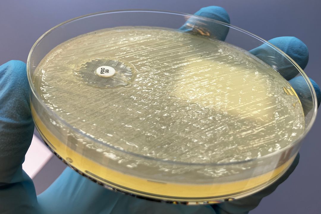isolierte Bakterien auf Agar in Petrischale