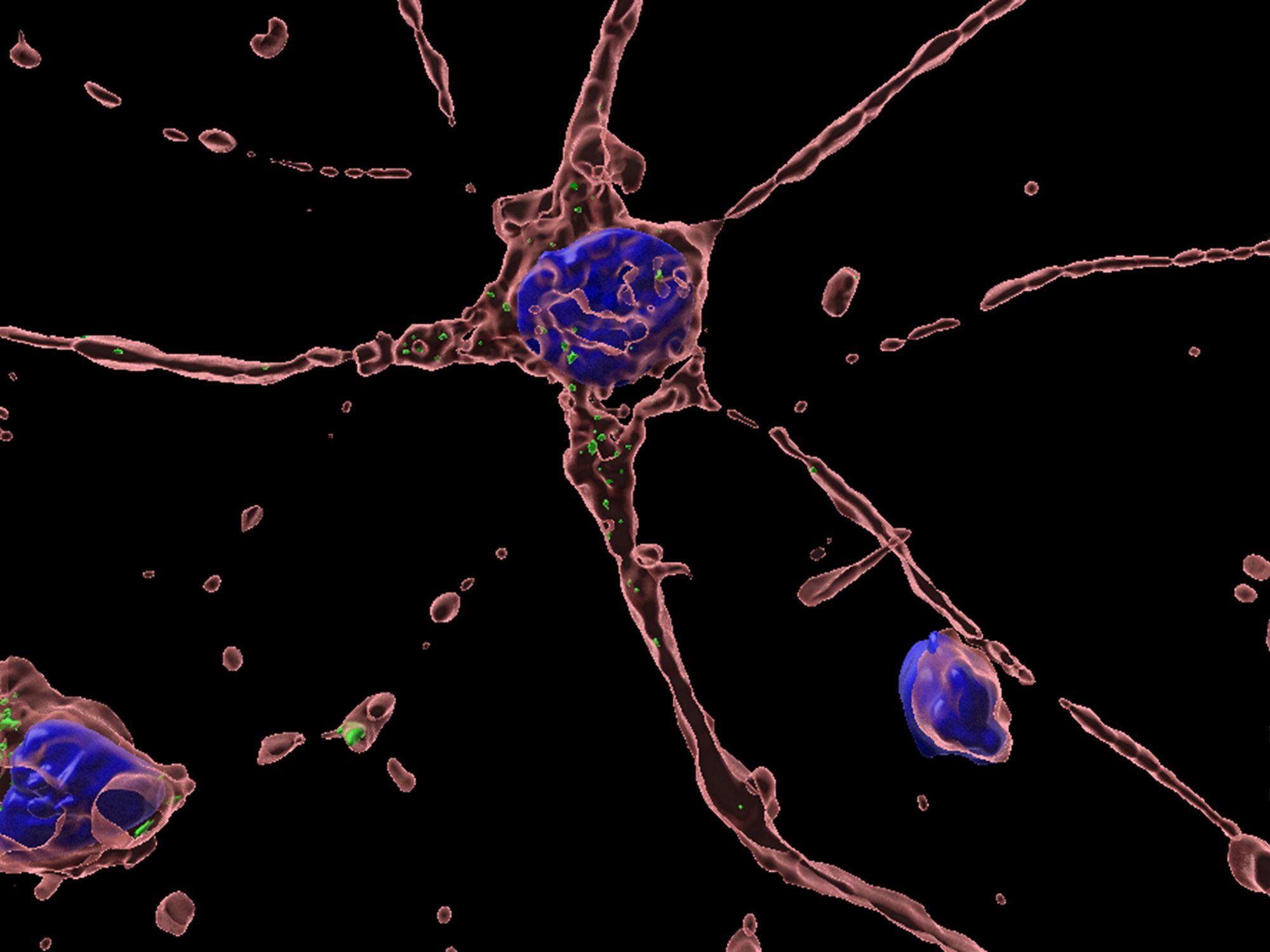 Mit Hepatitis E infizierte primäre Neurone aus menschlichen Nierenzellen Mit Hepatitis E infizierte primäre Neurone aus menschlichen Nierenzellen, die mit dem Urin ausgeschieden werden