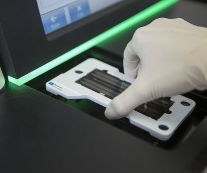 Sensitive NGS-Methoden ermöglichen den gleichzeitigen Nachweis zahlreicher genetischer Veränderungen in der ctDNA.