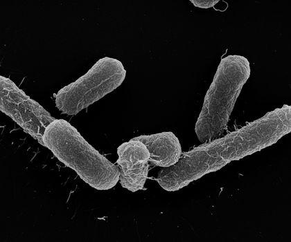 Studie zu multiresistenten Darmbakterien Elektronenmikroskopische Aufnahme des E.-coli-Stamms, der multiresistente E.-coli-Stämme verdrängen kann.