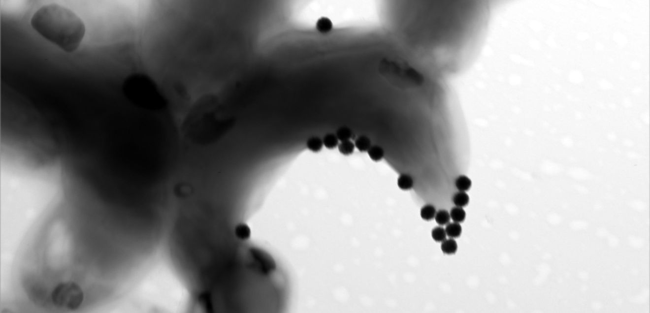 Protokolle zu Expositionssystemen für Tests: Ökotoxizität von Mikro- und Nanoplastik bewerten Algenzelle, an der Nano-Kunststoffpartikel haften