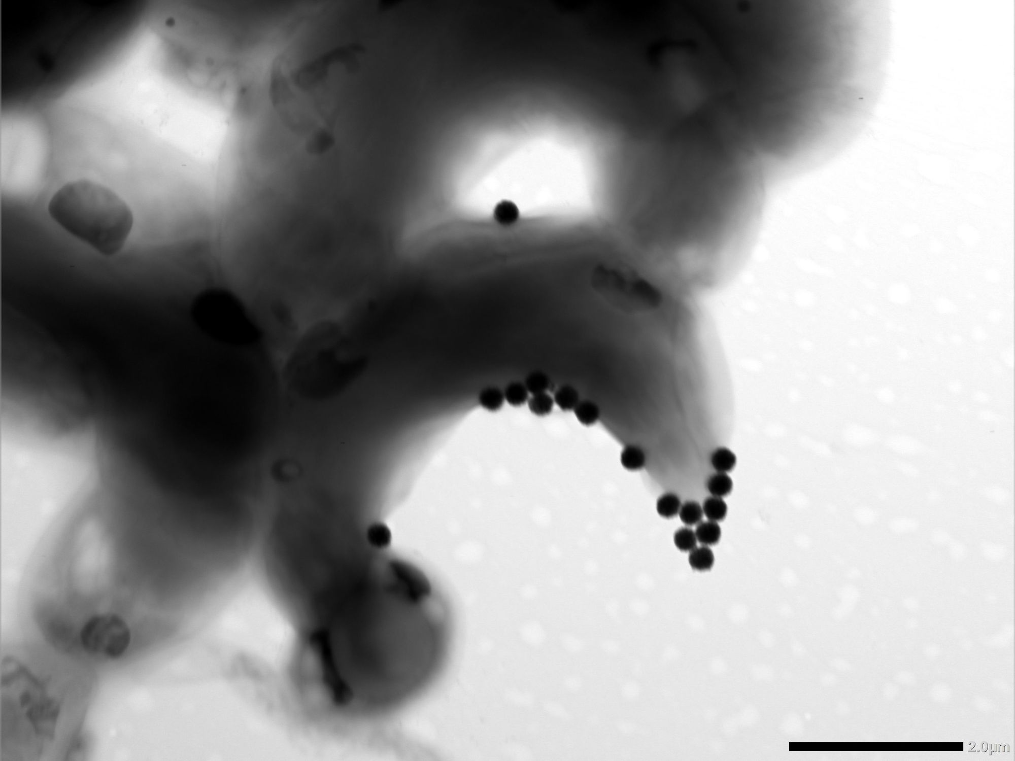 Protokolle zu Expositionssystemen für Tests: Ökotoxizität von Mikro- und Nanoplastik bewerten Algenzelle, an der Nano-Kunststoffpartikel haften
