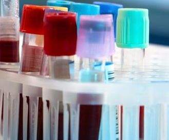 Qualitätssicherung labormedizinischer Untersuchungen: BÄK-Richtlinie setzt strengere Maßstäbe für Laboruntersuchungen Qualitätssicherung labormedizinischer Untersuchungen: BÄK-Richtlinie setzt strengere Maßstäbe für Laboruntersuchungen