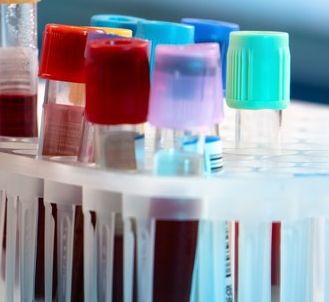 Qualitätssicherung labormedizinischer Untersuchungen: BÄK-Richtlinie setzt strengere Maßstäbe für Laboruntersuchungen Qualitätssicherung labormedizinischer Untersuchungen: BÄK-Richtlinie setzt strengere Maßstäbe für Laboruntersuchungen