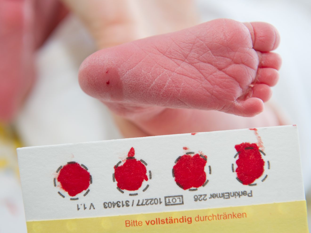 Bluttropfen kann Leben retten: Babyscreening auf Krankheiten Bluttropfen kann Leben retten: Babyscreening auf Krankheiten