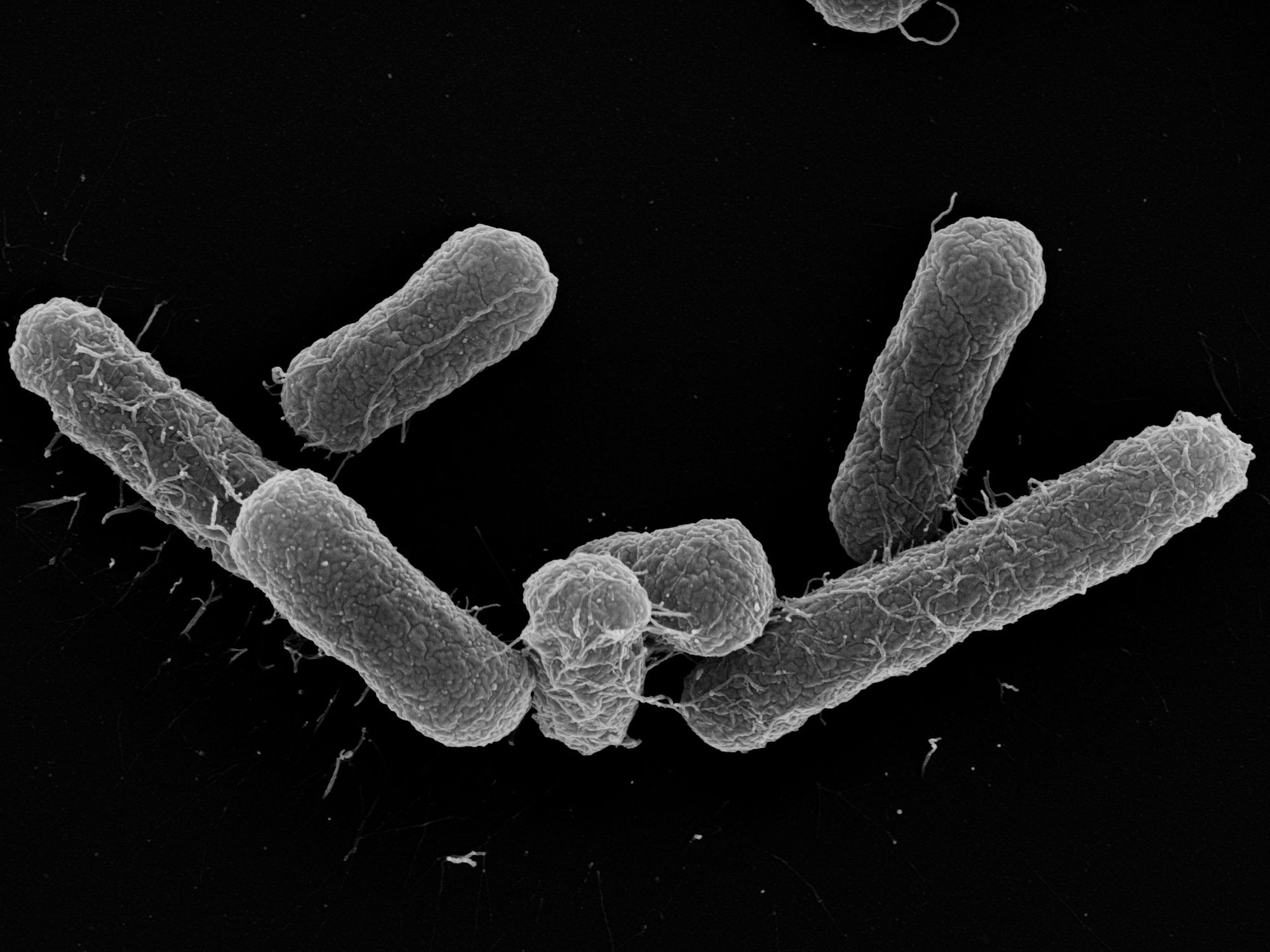 Studie zu multiresistenten Darmbakterien Elektronenmikroskopische Aufnahme des E.-coli-Stamms, der multiresistente E.-coli-Stämme verdrängen kann.