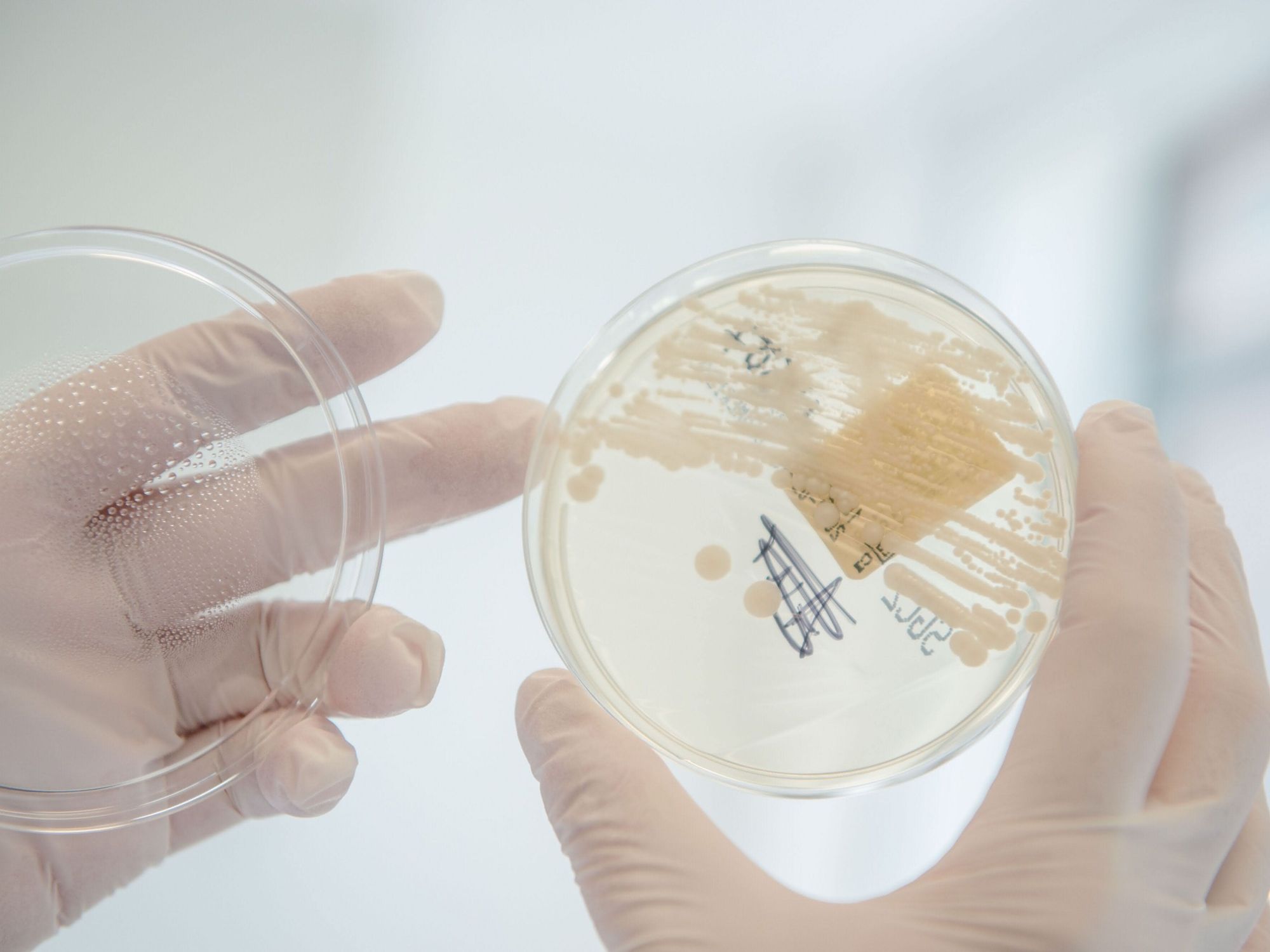 Petrischale mit Bakterienkultur für Antibiotikaforschung Petrischale mit Bakterienkultur