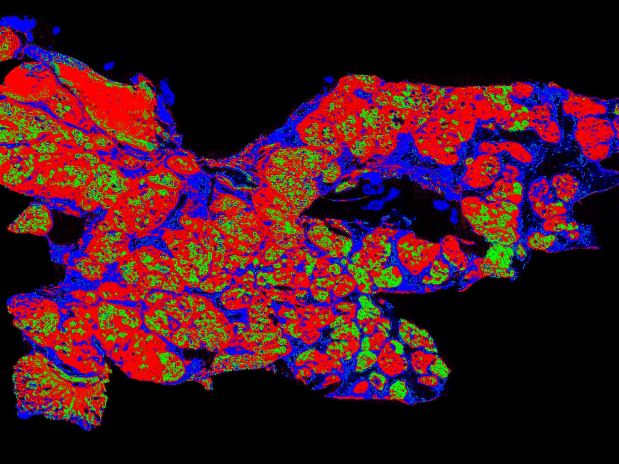 Mikroskopische Aufnahme (Bauchspeicheldrüsengewebe) aufgenommen mit dem HYPERION II-ILIM-Mikroskop