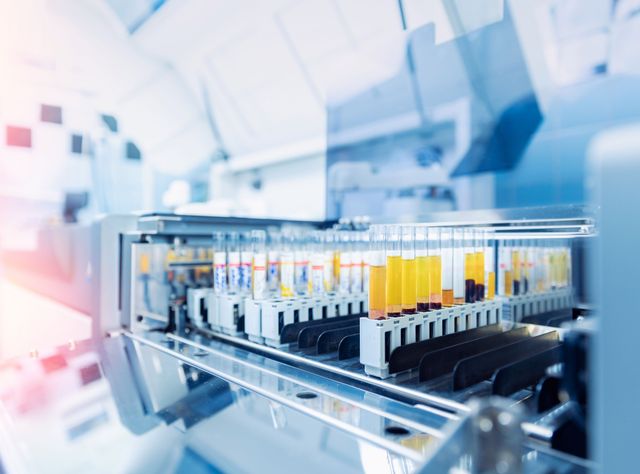 EU-Verordnung über In-vitro-Diagnostik: Anforderungen für medizinische Labore Medizinische Proben für die Labordiagnostik