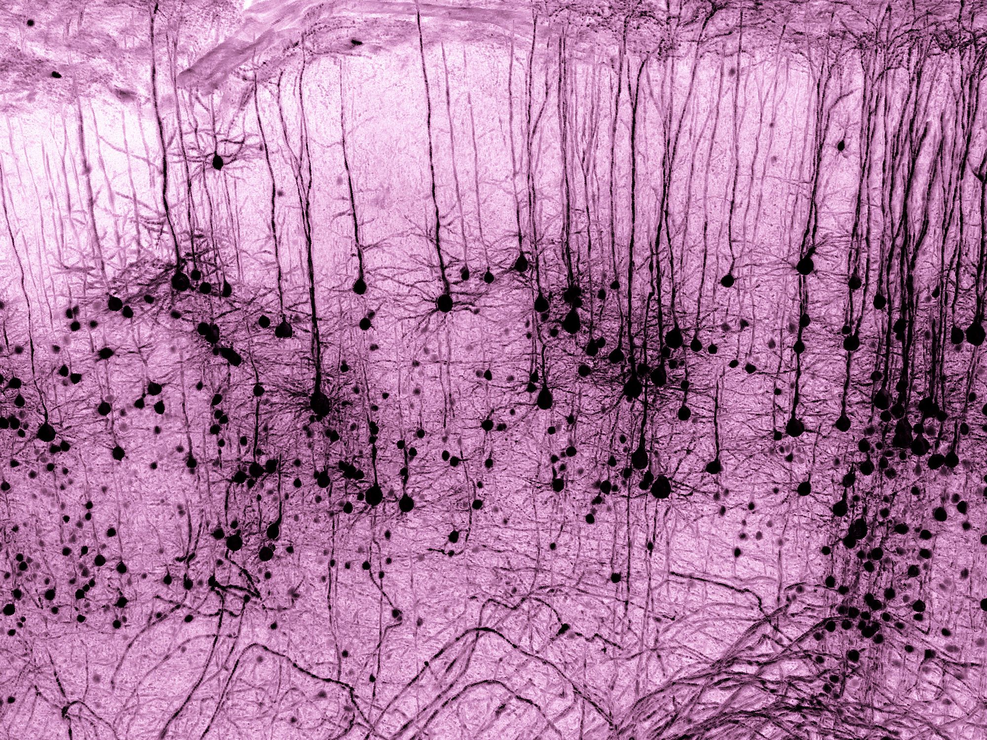 Ehrenhaft erwähnt im Wettbewerb Image of the Year wurde das Mikroskop-Bild 'GFP-positives Thy1-Neuron in einem geklärten Mausgehirn'. Aufgenommen von Marko Pende (Österreich). Ehrenhaft erwähnt im Wettbewerb Image of the Year wurde das Mikroskop-Bild 'GFP-positives Thy1-Neuron in einem geklärten Mausgehirn'. Aufgenommen von Marko Pende (Österreich).