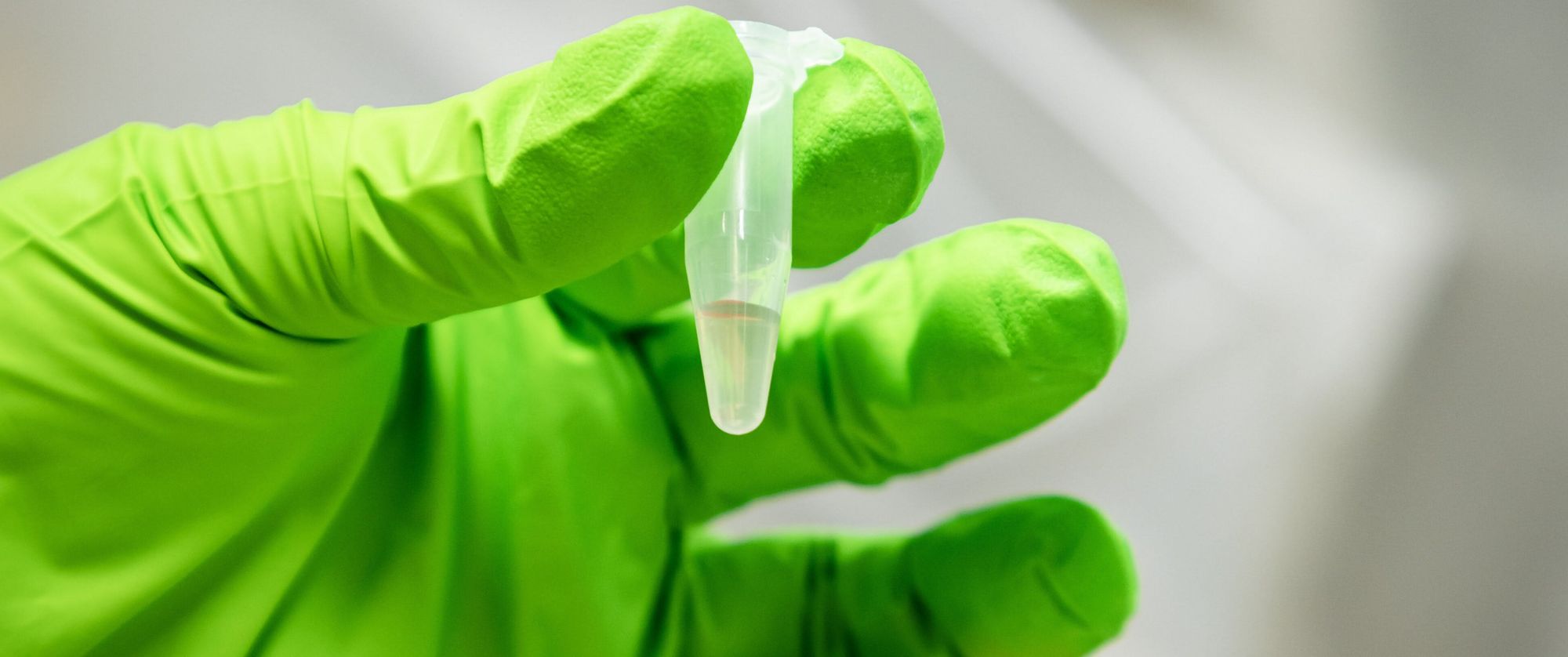 Abwasserprobe für die Sequenzierung Abwasserprobe für die Sequenzierung