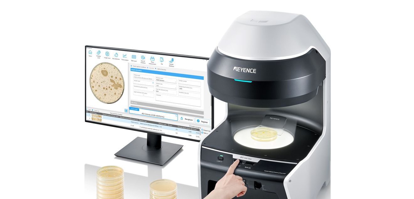 Automatischer Kolonienzähler: Digitalisierter Workflow für mikrobiologische Proben automatischer Kolonienzähler BC-1000