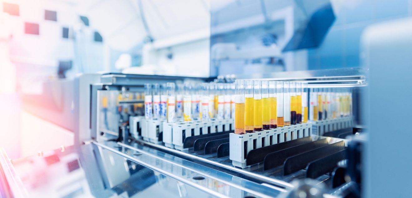 EU-Verordnung über In-vitro-Diagnostik: Anforderungen für medizinische Labore Medizinische Proben für die Labordiagnostik