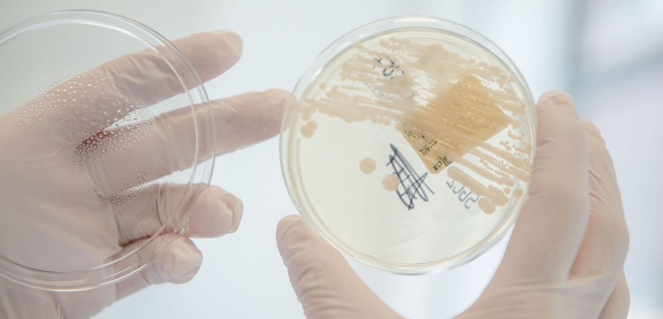 Petrischale mit Bakterienkultur für Antibiotikaforschung Petrischale mit Bakterienkultur