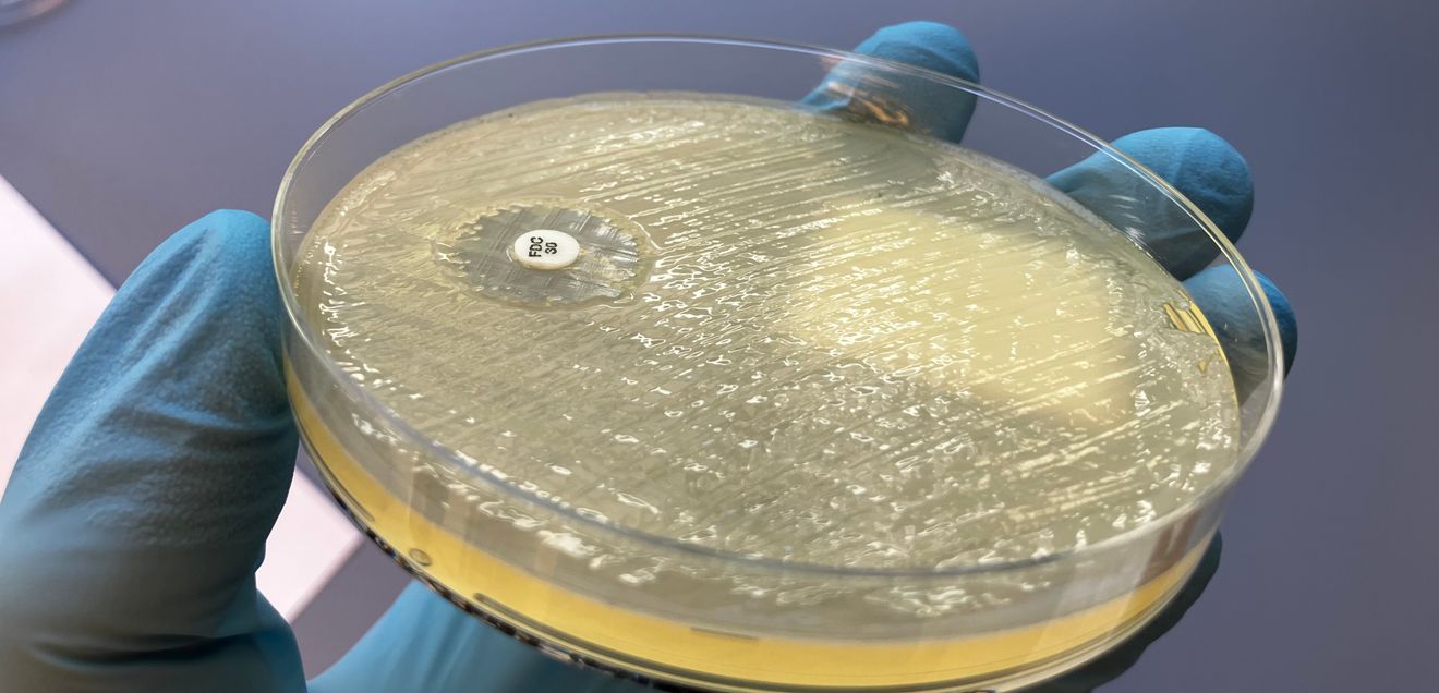 isolierte Bakterien auf Agar in Petrischale isolierte Bakterien auf Agar in Petrischale