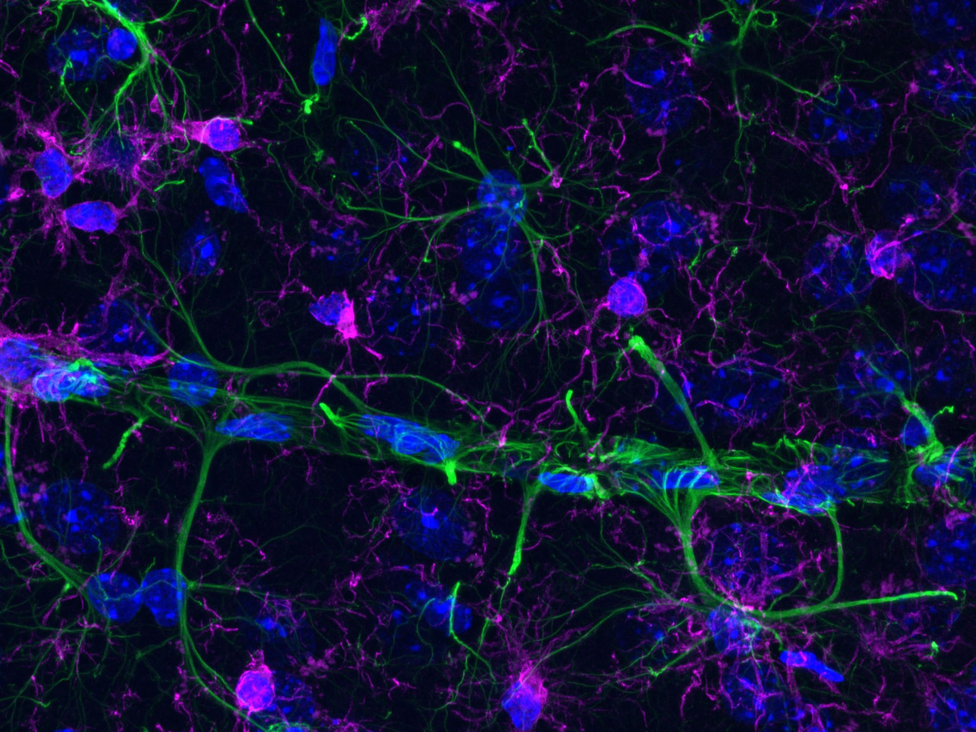 Ehrenhaft erwähnt im Wettbewerb Image of the Year wurde das Mikroskop-Bild Fluoreszenz-immunhistochemisch gefärbtes Hirngewebe aus einem Mausmodell der Alzheimer-Krankheit. Aufgenommen von Bettina Rákóczi (Ungarn). Ehrenhaft erwähnt im Wettbewerb Image of the Year wurde das Mikroskop-Bild Fluoreszenz-immunhistochemisch gefärbtes Hirngewebe aus einem Mausmodell der Alzheimer-Krankheit. Aufgenommen von Bettina Rákóczi (Ungarn).