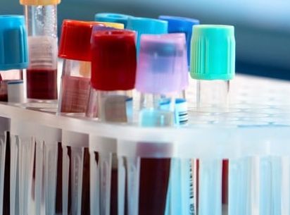 Qualitätssicherung labormedizinischer Untersuchungen: BÄK-Richtlinie setzt strengere Maßstäbe für Laboruntersuchungen Qualitätssicherung labormedizinischer Untersuchungen: BÄK-Richtlinie setzt strengere Maßstäbe für Laboruntersuchungen
