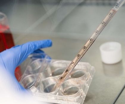 Pipettieren Foto: Pipettiervorgang im Labor