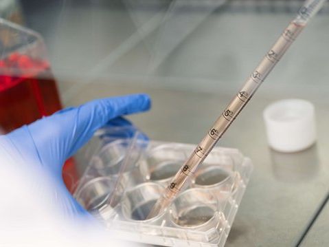Pipettieren Foto: Pipettiervorgang im Labor