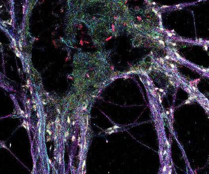 Einzelproteinauflösung durch die Darstellung in einer segmentierten Einzelsynapse Einzelproteinauflösung durch die Darstellung in einer segmentierten Einzelsynapse