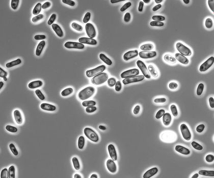 Gefährliche Pilzinfektionen: DSMZ stellt WHO-priorisierte Pilze für Forschung bereit Gefährliche Pilzinfektionen: DSMZ stellt WHO-priorisierte Pilze für Forschung bereit