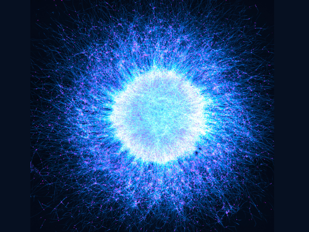Image of the Year Award: Evident zeichnet das Mikroskopie-Bild des Jahres aus Katie Holden aus dem Vereinigten Königreich wurde als globale Gewinnerin für ihr beeindruckendes Bild mit dem Titel „Neuronal Cosmos“ gekürt. Das Bild zeigt aus induzierten pluripotenten Stammzellen gewonnene Neurosphären, die aus neuronalen Zellen bestehen, und sich selbstorganisierend zu Strukturen anordnen, die der geschichteten Architektur des menschlichen Gehirns ähneln.