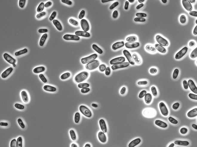 Gefährliche Pilzinfektionen: DSMZ stellt WHO-priorisierte Pilze für Forschung bereit Gefährliche Pilzinfektionen: DSMZ stellt WHO-priorisierte Pilze für Forschung bereit