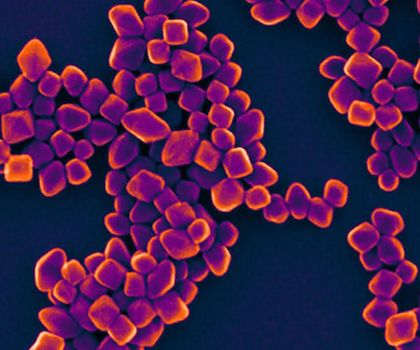Titandioxid-Nanopartikel unter dem Elektronenmikroskop Titandioxid-Nanopartikel unter dem Elektronenmikroskop