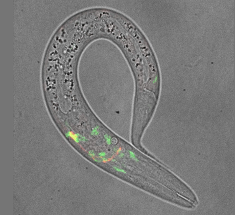 Somatostatin, Schlaf und die kleine Zelle, die über Gedächtnis und Alter entscheidet Mikroskopische Aufnahme des Fadenwurms C. elegans.