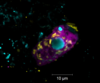 Belasten Kläranlagen das Klima? Symbiotische Bakterien klären Abwasser und erzeugen Treibhausgase Der Endosymbiont Candidatus Azoamicus mariagerensis und sein Ciliatenwirt unter dem Fluoreszenzmikroskop.