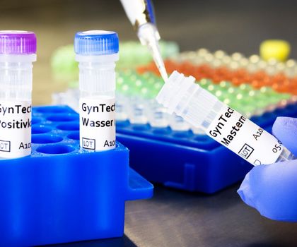 Komponenten des Tests „GynTect“ Komponenten des Tests „GynTect“