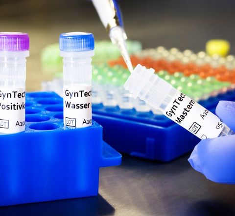 Komponenten des Tests „GynTect“