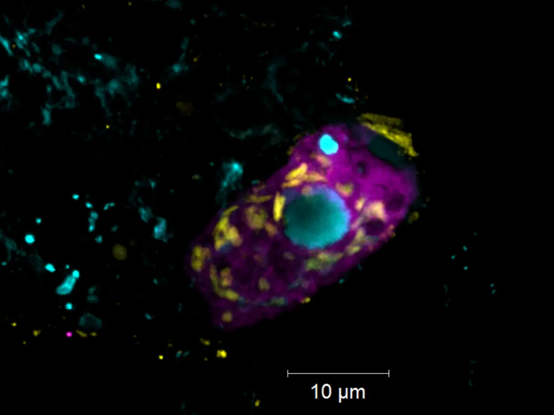 Belasten Kläranlagen das Klima? Symbiotische Bakterien klären Abwasser und erzeugen Treibhausgase Der Endosymbiont Candidatus Azoamicus mariagerensis und sein Ciliatenwirt unter dem Fluoreszenzmikroskop.