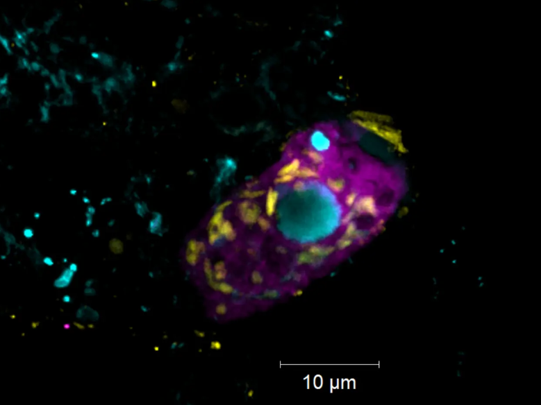 Belasten Kläranlagen das Klima? Symbiotische Bakterien klären Abwasser und erzeugen Treibhausgase Der Endosymbiont Candidatus Azoamicus mariagerensis und sein Ciliatenwirt unter dem Fluoreszenzmikroskop.