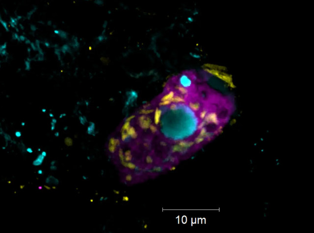 Der Endosymbiont Candidatus Azoamicus mariagerensis und sein Ciliatenwirt unter dem Fluoreszenzmikroskop.