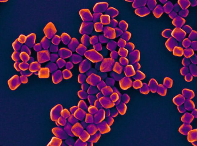 Titandioxid-Nanopartikel unter dem Elektronenmikroskop Titandioxid-Nanopartikel unter dem Elektronenmikroskop
