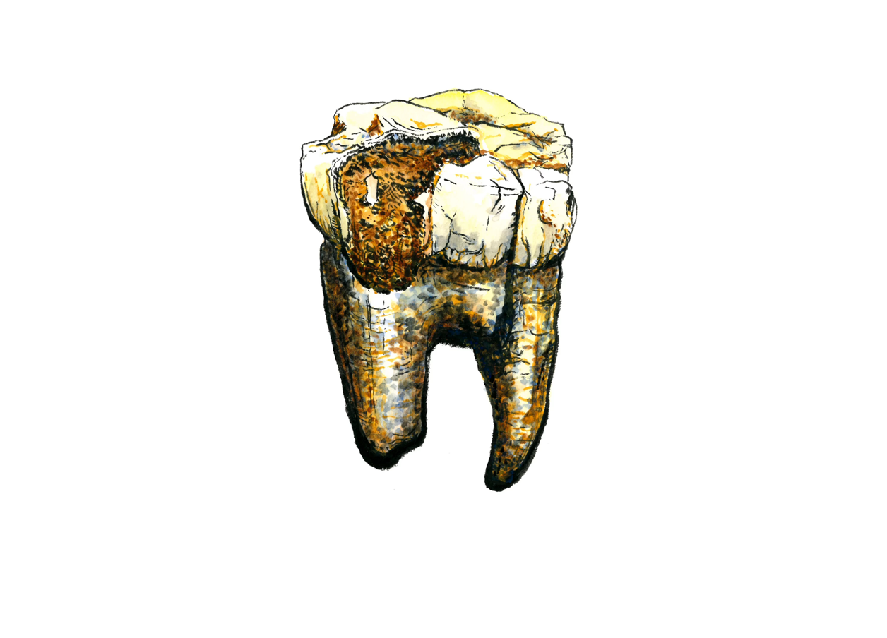 Backenzahn Australopithecus Darstellung einer der sieben beprobten Backenzähne von Australopithecus